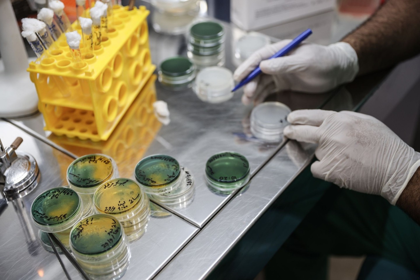 Ein Labortechniker bearbeitet Proben von Choleraverdachtsfällen in einem medizinischen Labor.